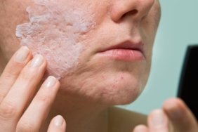 a-woman-treating-acne-and-wondering-the-differences-between-salicylic-acid-vs-benzoyl-peroxide.jpg