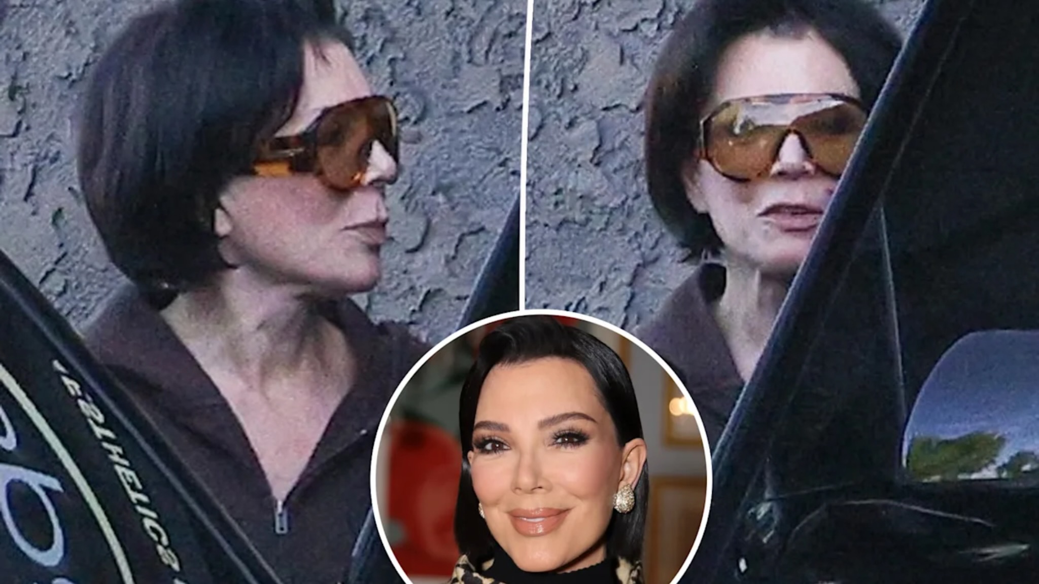 Kris Jenner shpërthen ndaj thashethemeve për fytyrën e saj   Jam e fiksuar pas  