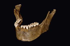 NEWS-Human-tooth-enamel-structure-changed-with-a-change-in-diet-493752_hd.jpg