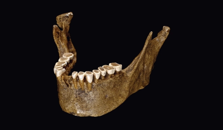 NEWS-Human-tooth-enamel-structure-changed-with-a-change-in-diet-493752_hd.jpg