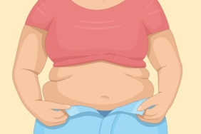 Pcos-belly-shape-preview-1200x768-1.jpg