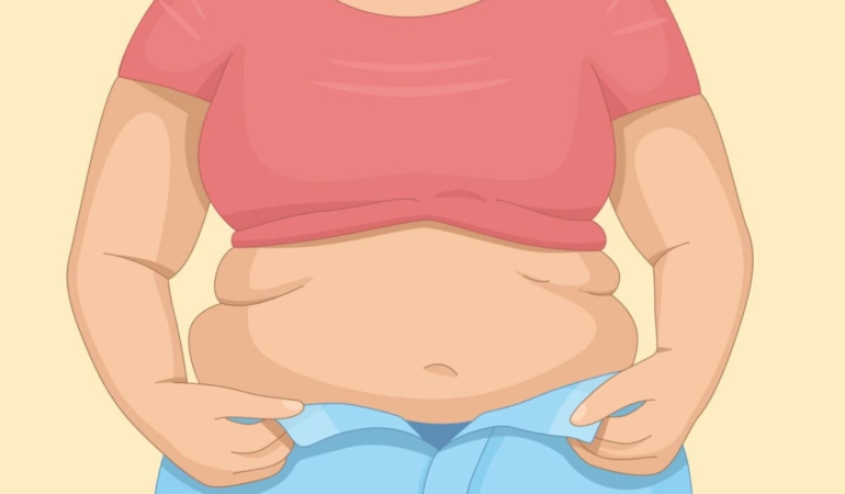 Pcos-belly-shape-preview-1200x768-1.jpg