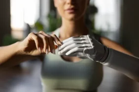 front-view-woman-with-prosthetic-arm-696x464 (1)