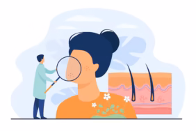 tiny-dermatologist-examining-dry-face-skin-flat-vector-illustration-abstract-epidermis-disease-diagn.avif