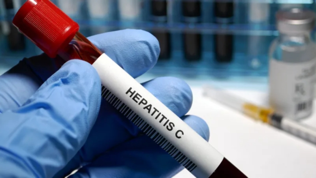 Një nga vendet e para që do të eliminojë hepatitin C…