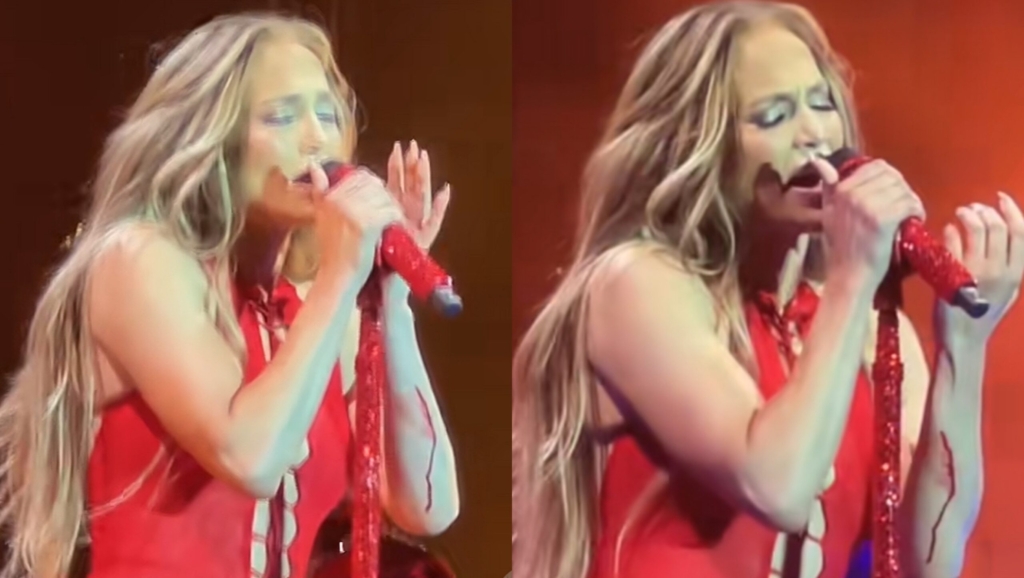 Jennifer Lopez lëndohet dhe fillon t’i rrjedhë gjak në skenë?