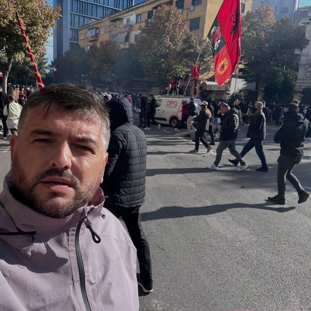 Erjon Vishkulli: Një rrugëtim i vështirë pas operacionit në Itali