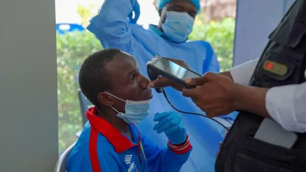 Mbi 5 mijë të vdekur nga Ebola në Kongo, shpërthimi më vdekjeprurës në vend