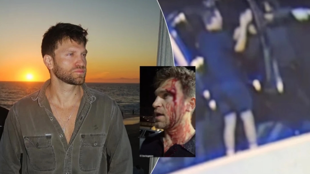 Sulmohet brutalisht ylli i “Pretty Little Liars”, Keegan Allen?