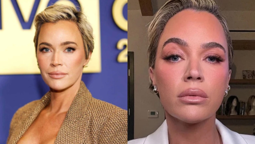 Teddi Mellencamp i nënshtrohet një ndërhyrjeje estetike gjatë trajtimit të kancerit?